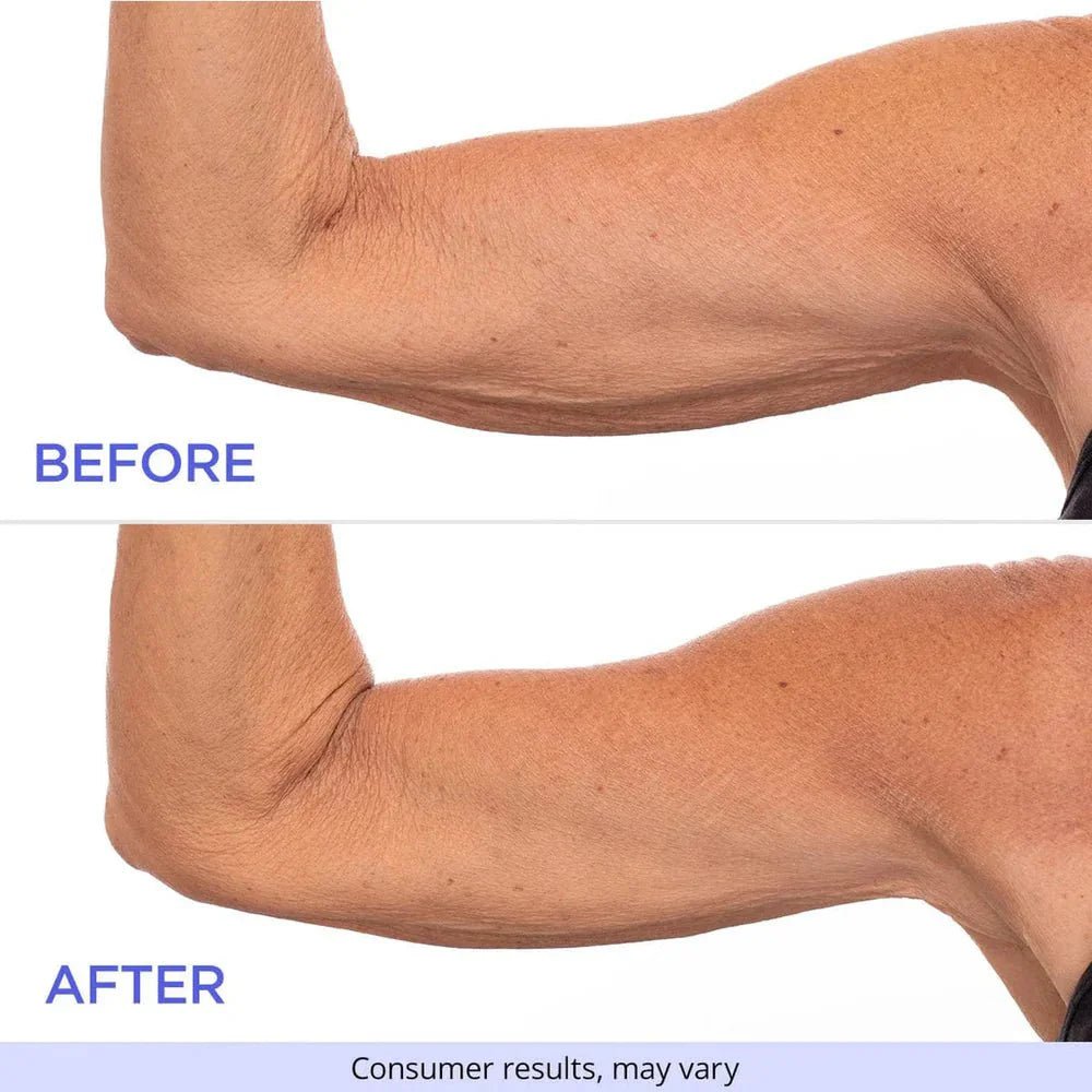 SculptSkin™ - Voor een Stevige, Gladde Huid Zonder Gedoe - Zinavić