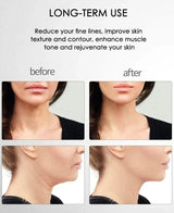 Skinlift™ - Dé oplossing voor een strakke en gezonde huid! - Zinavić