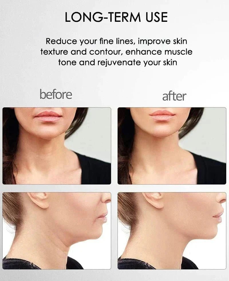 Skinlift™ - Dé oplossing voor een strakke en gezonde huid! - Zinavić